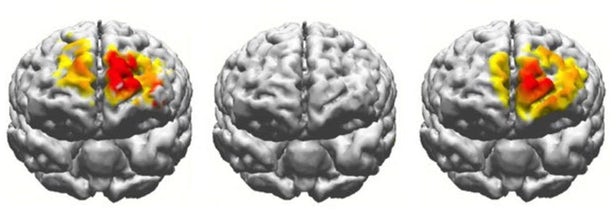 brain-stimulation-50-years-3.jpg