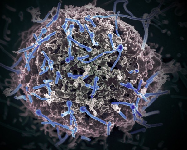 埃博拉病毒可在精液中存活9个月 世卫建议使用安全套